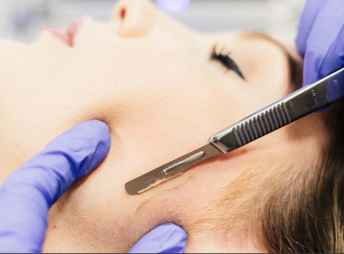 Facial con dermaplaning