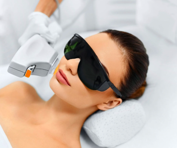 Christmas Offer Fotorejuvenecimiento IPL 5 X