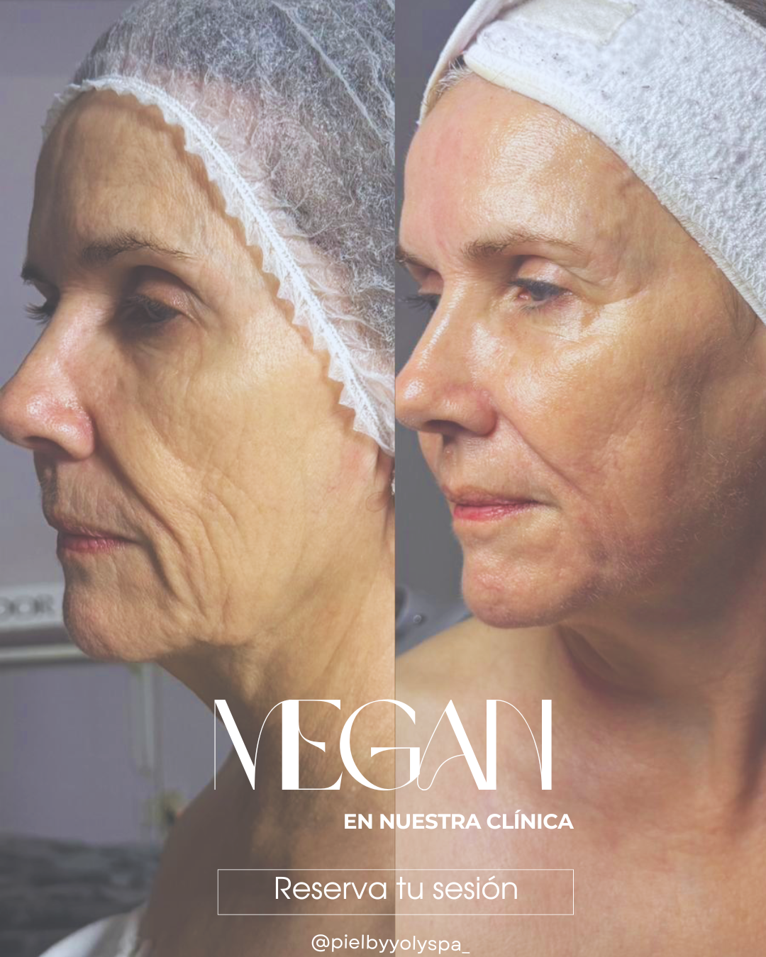 Christmas Offer Megan 2 X