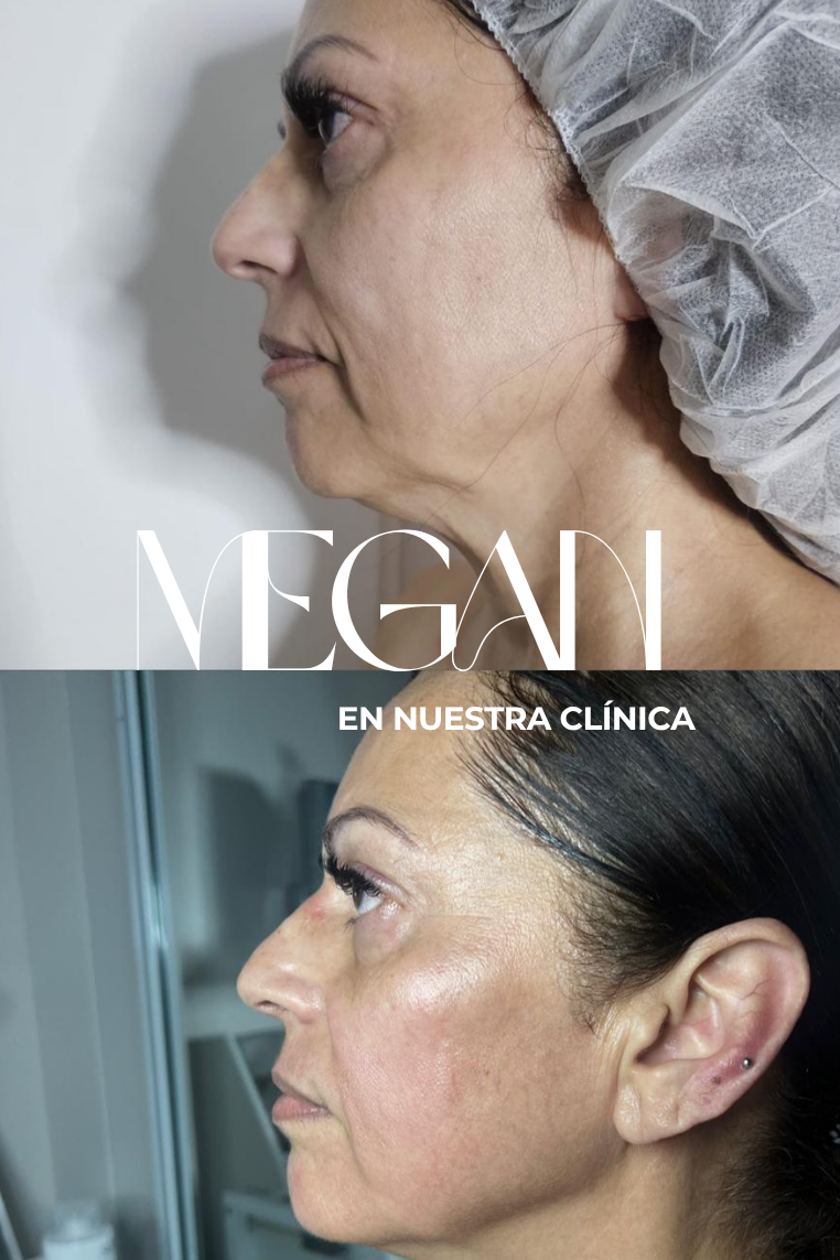 Christmas Offer Megan 5 X