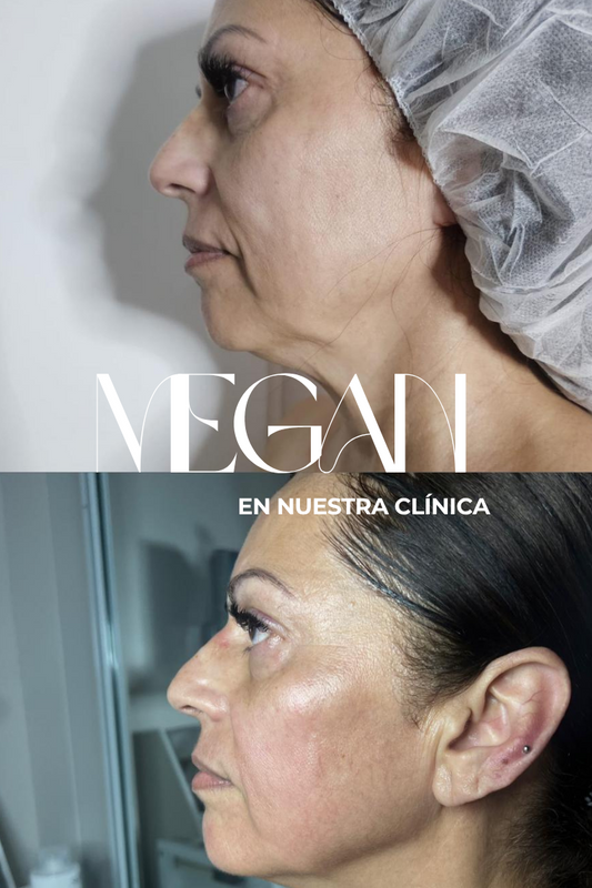 Christmas Offer Megan 5 X