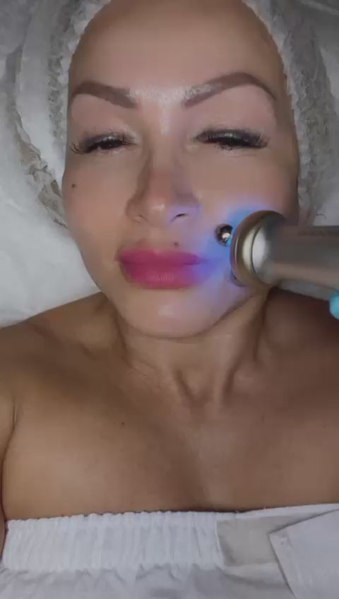 Christmas Offer Radiofrecuencia 6 X